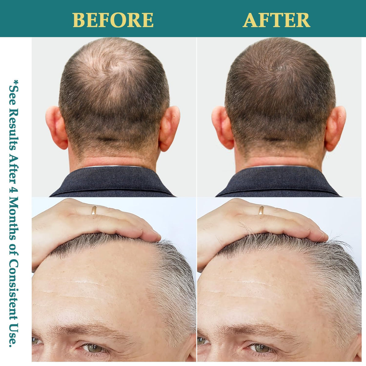 Natural Hair Growth Oil Spray: Natural Formula with Batana, Castor and Rosemary Oil, Rice Water, and Biotin for Women and Men